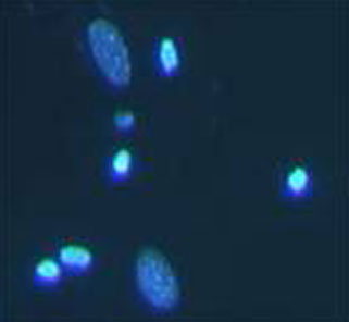 hoechst33342/pi细胞凋亡染色试剂盒