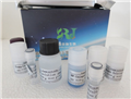 兔子可溶性P选择素(sP-selectin)ELISA试剂盒